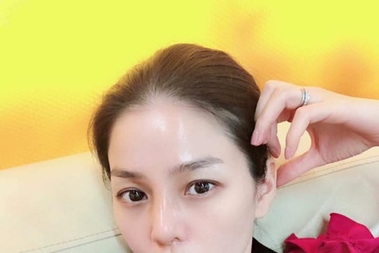 Lệ Quyên tháo sụn mũi giả để tránh nguy hiểm tính mạng