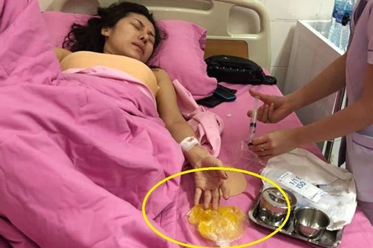 Nổ túi ngực trên máy bay sau 7 năm bơm silicon