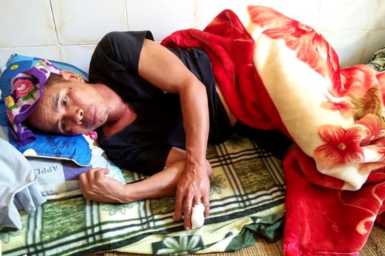 Dân làng vây bắt lợn rừng gần 1 tạ húc thủng bụng, cắn đứt ngón tay người