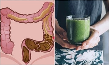 10 cách đơn giản giúp thải độc đường ruột, hỗ trợ giảm cân
