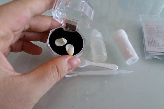 Mua răng... trên mạng, trào lưu làm đẹp nguy hiểm 