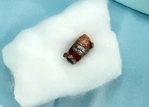 Thanh niên dùng súng bút bắn bạn của anh trai