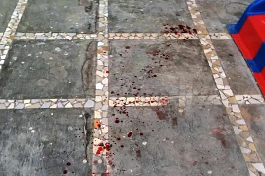 Đá rơi làm cháu bé 3 tuổi tử vong khi chơi dưới sân chung cư ở Nghệ An