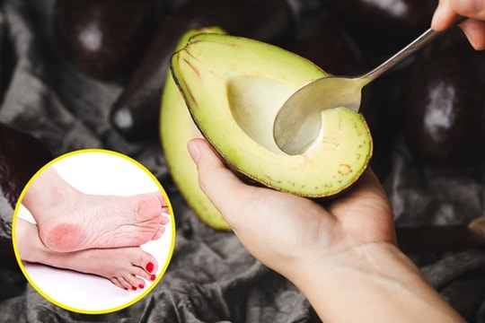 Mẹo làm đẹp với trái bơ không phải ai cũng biết