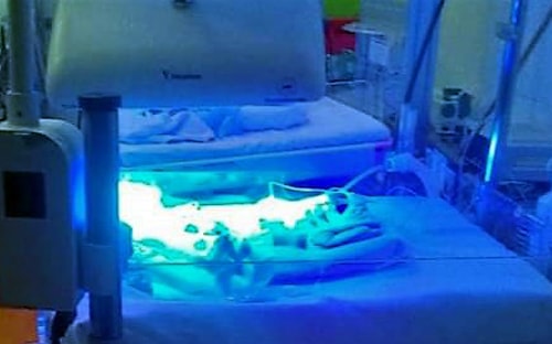 Bé trai 1,2 kg bị bỏ rơi trong bọc nylon