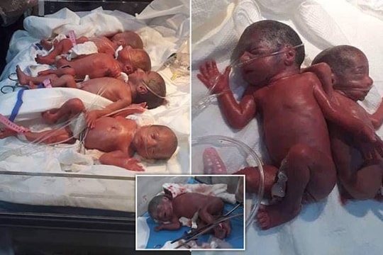 Ca sinh 7 hiếm gặp của người mẹ 25 tuổi