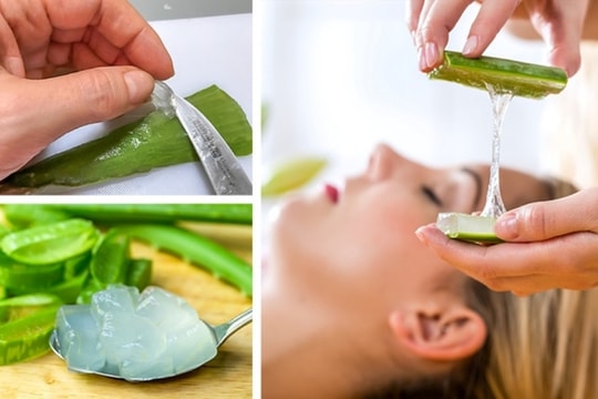 9 mẹo dùng gel lô hội trị đủ vấn đề về da