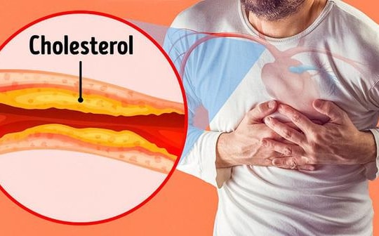 8 dấu hiệu thầm lặng của tắc động mạch không nên bỏ qua