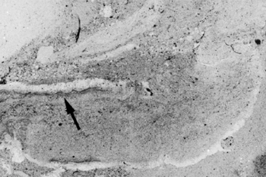 Phát hiện hóa thạch giun 500 triệu năm tuổi dưới đáy biển cổ đại