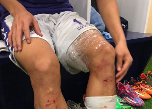 Quế Ngọc Hải bị tố vào bóng triệt hạ; Đưa MU vào tứ kết, Solskjaer “nguy cơ” trở về Molde