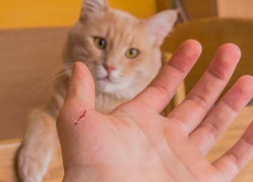 Cậu bé mắc bệnh tâm thần vì bị mèo cào