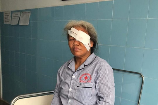 Người phụ nữ bị trâu húc tổn thương mắt