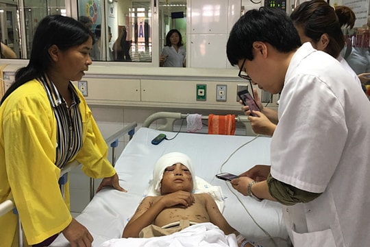 Bé trai bị chó cắn mất 2 tai đang được theo dõi chấn thương sọ não