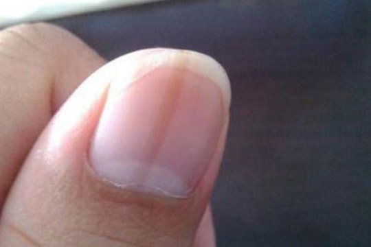 3 bộ phận trên cơ thể báo hiệu gan đang suy yếu