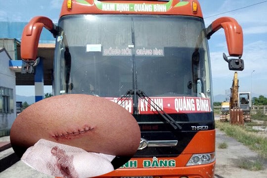 Đánh phụ xe trọng thương, cướp hàng ô tô khách trên Quốc lộ 1A đoạn qua Nghệ An