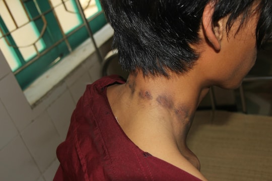 Đôi vợ chồng trẻ người Mông ở Nghệ An bị sét đánh ngang cổ