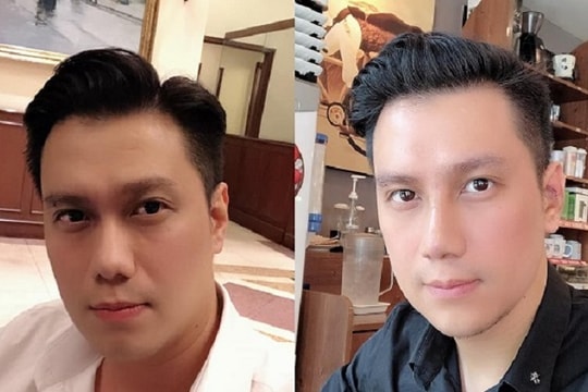 Diễn viên Việt Anh bị chê xấu sau phẫu thuật thẩm mỹ