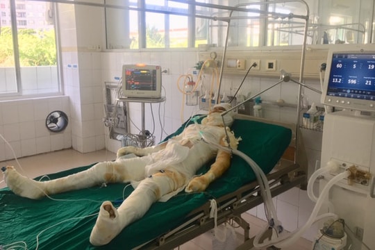 Kẻ tẩm xăng giết 'vợ hờ' đối mặt án tử hình