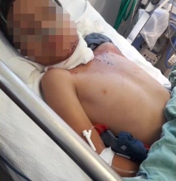 Cha con người di cư bị cứa cổ, bỏ lại bên đường ở Mexico