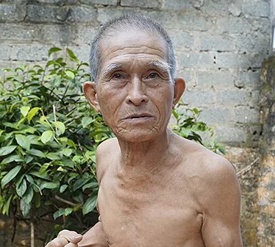 Cụ già 80 tuổi ăn ngày 15 bát cơm, 'tráng miệng' 15 quả trứng vịt lộn mỗi bữa