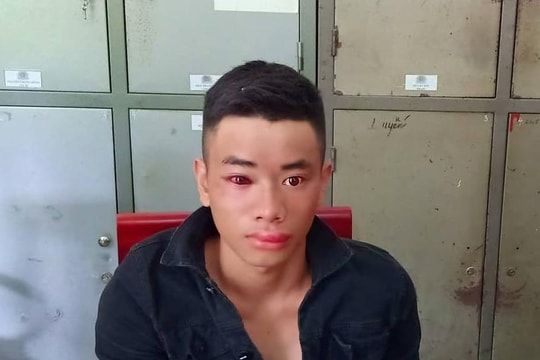 Con nghiện ma túy dùng kim tiêm đâm bị thương thiếu úy công an