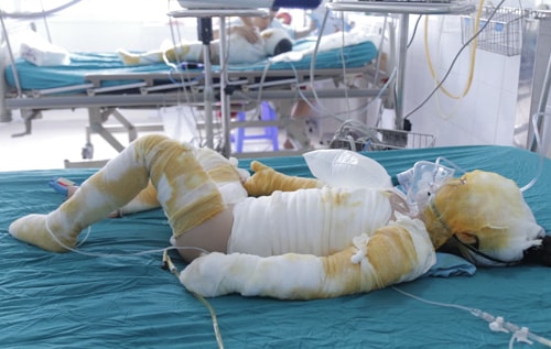 Ba trẻ mầm non tư thục bỏng nặng khi học kỹ năng thoát hiểm