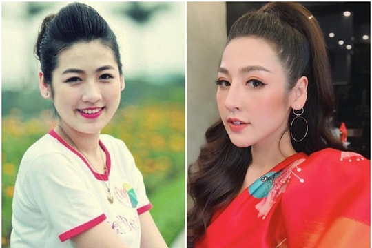 Á hậu Tú Anh và nghi vấn phẫu thuật thẩm mỹ