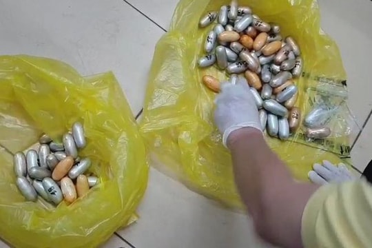 Người đàn ông nuốt 1,6 kg ma túy trong bụng đi qua 4 quốc gia