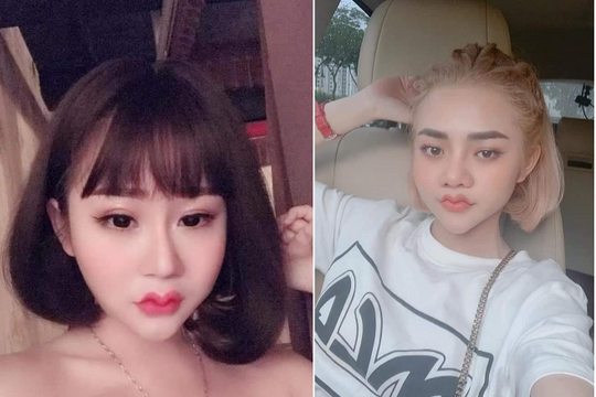 Trào lưu làm đẹp môi 'lượn sóng' gây tranh cãi 