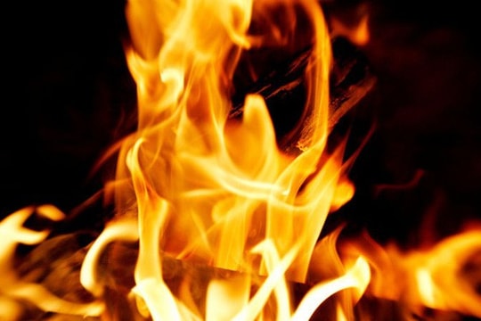 Nỗi đau của người vợ bị chồng đổ xăng đốt, con trai 2 tuổi  bỏng nặng  ​