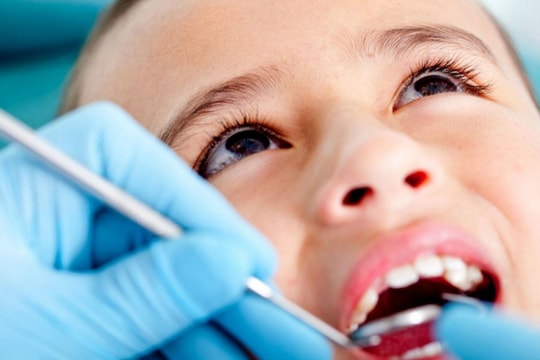 Xử trí khi răng sữa của trẻ bị đen