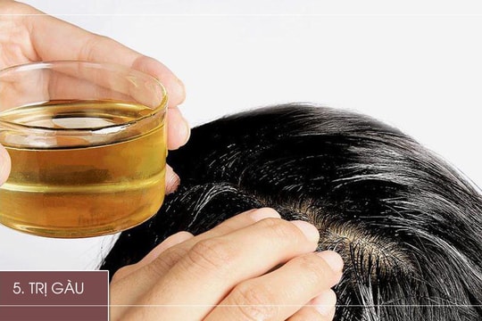 Gội đầu thế nào cho đúng cách