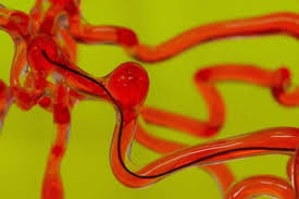 Robot có thể chui vào mạch máu não