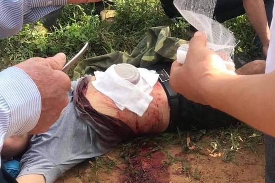 Sang hàng xóm lấy dao tự rạch bụng mình vì tưởng trong đó có bom 