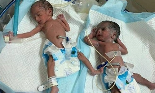 Bà cụ sinh đôi ở tuổi 73