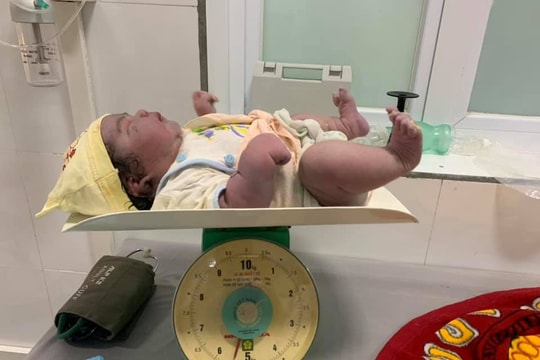 Hy hữu: Một sản phụ Nghệ An sinh thường bé gái nặng 5,5 kg