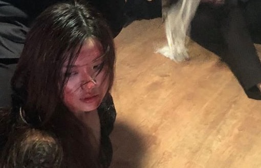 Diễn viên Lương Thanh bị đánh bầm dập trong 'Hoa hồng trên ngực trái'