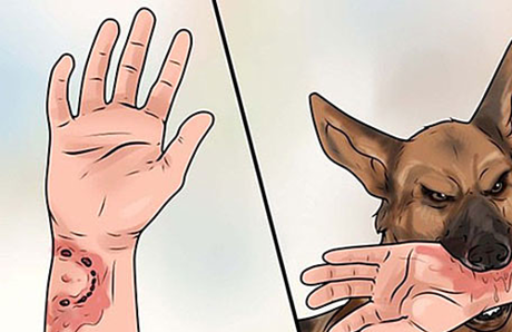 Cụ bà ở Nghệ An tử vong vì chó dại cắn