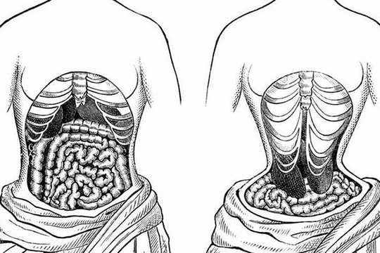 Đai nịt bụng có làm giảm mỡ bụng?
