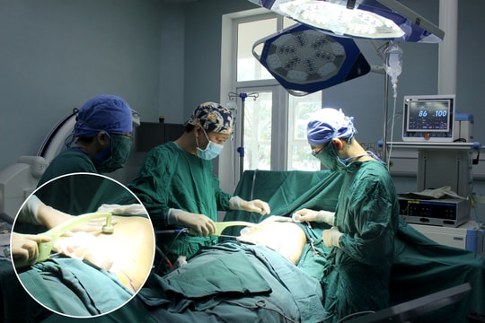 Tái tạo đường cong cơ thể không cần phẫu thuật tại Nghệ An