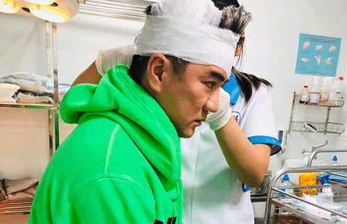 Đàm Vĩnh Hưng bị thương ở đầu