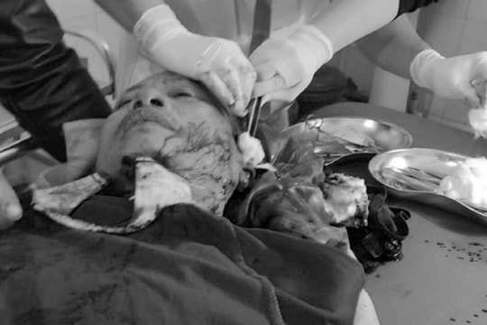 Công an viên xã ở Nghệ An bị nhóm đối tượng chém trọng thương