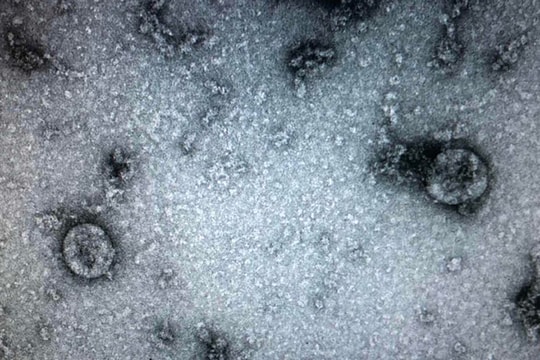 Nhà khoa học Việt tạo kit thử nCoV cho kết quả sau 70 phút