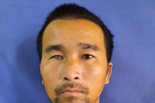 Khởi tố nam thanh niên đâm người trọng thương với hành vi côn đồ 