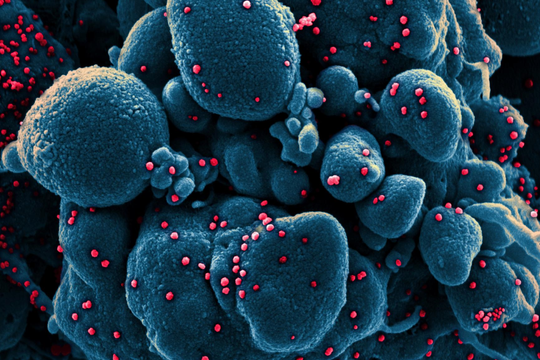 Tình báo Mỹ hoài nghi thông tin về dịch Covid-19 tại Trung Quốc, Nga và Triều Tiên