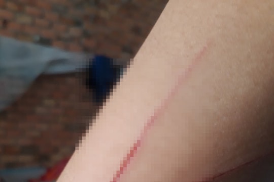 Thông tin bất ngờ vụ bé gái trong vụ án hiếp dâm bị chém trên đường