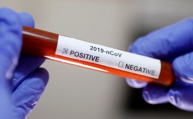 Việt Nam là nước thứ 5 trên thế giới sản xuất thành công sinh phẩm xét nghiệm kháng thể