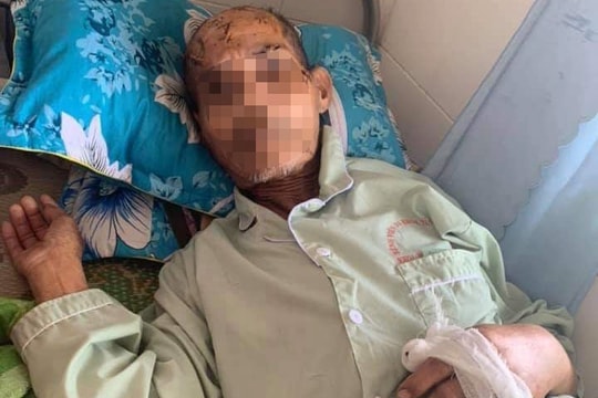 Khởi tố, bắt tạm giam cháu nội chém ông nhiều nhát vào đầu vì tranh giành đất