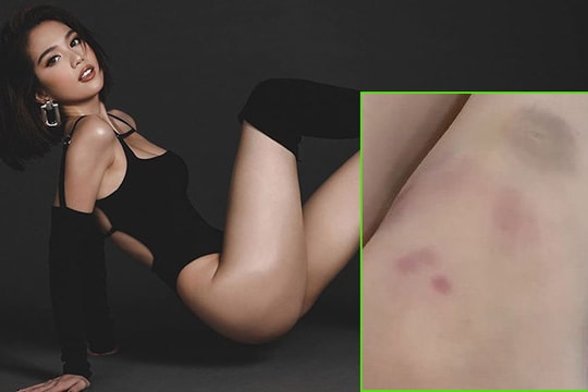 'Nữ hoàng nội y' Ngọc Trinh buột cười khi nói lý do...thâm hai đầu gối