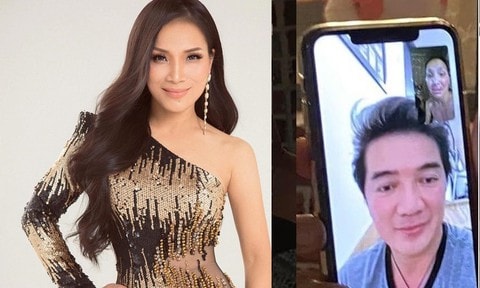 Ca sĩ Hồng Ngọc lần đầu tiên lộ gương mặt biến dạng vì bỏng nặng